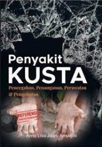 Penyakit Kusta, Pencegahan, Penanganan, Perawatan dan Pengobatan