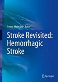 Stroke Revisited, Hemorrhagic Stroke