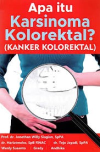 Apa Itu Karsinoma Kolorektal? (Kanker Kolorektal)